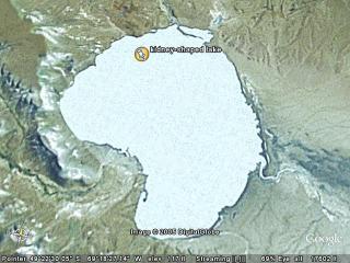 kidney-shaped lake